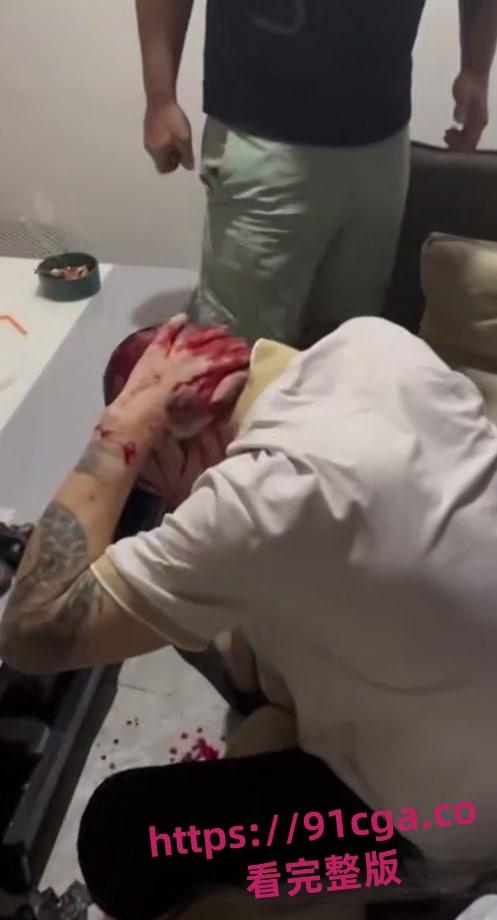 中国绑匪在菲律宾内讧 上演血腥狗咬狗 头破血流枪口相向-3