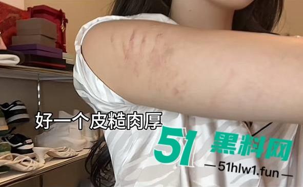 两位抖音百万网红,前CUBA成员【程鑫凯】家暴【鸡腿诺】事件持续发酵,未流出资料曝光完整吃瓜。-23